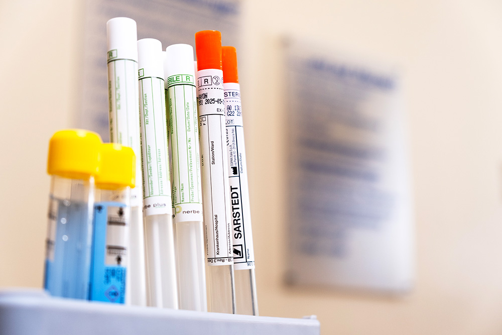 Screening auf sexuell übertragbare Infektionen